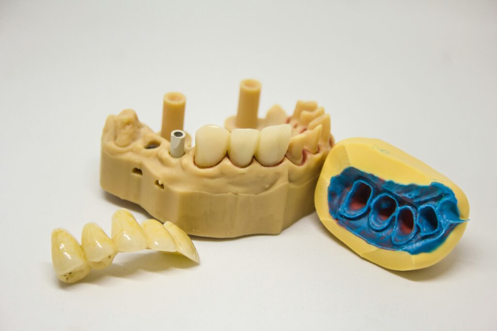 Composite bonding